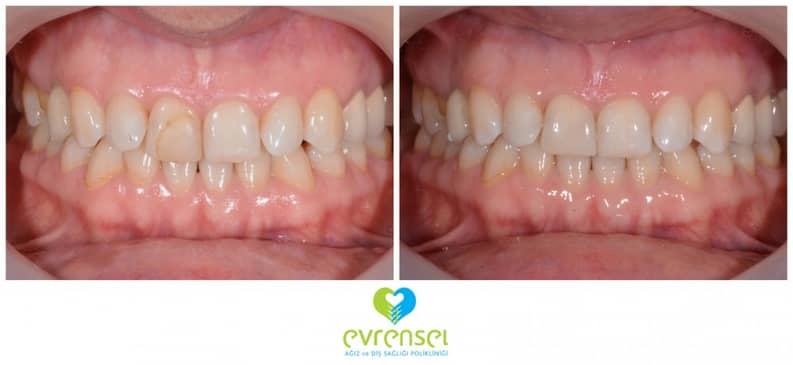 Slider image (7) Evrensel Dental Clinic in Ankara Turkey